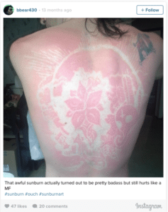 Sunburn Art