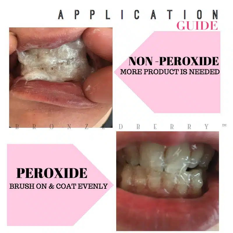 led teeth whitening gel guide